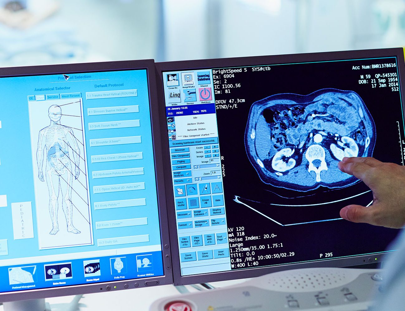 24/7 ct scan centre in hyderabad